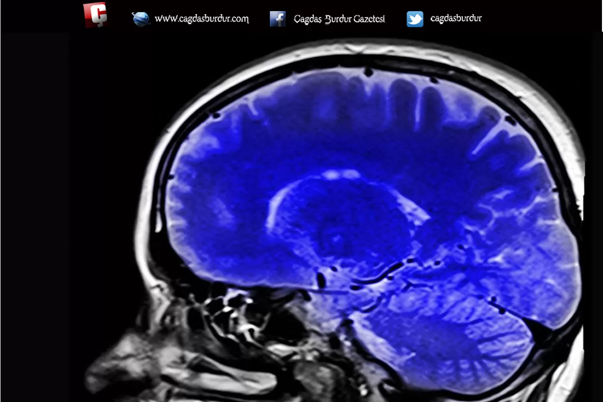 KRONİK AĞRILARIN BEYİNDEKİ KAYNAĞINI İNCELEYEN ARAŞTIRMA, HASTALARA UMUT OLABİLİR