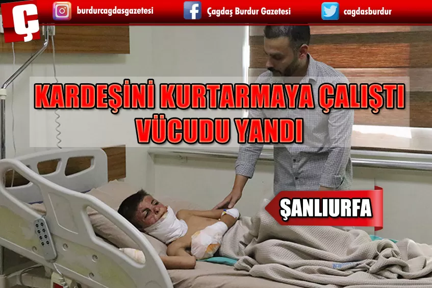 KARDEŞİNİ KURTARMAYA ÇALIŞIRKEN VÜCUDU YANAN AZERBAYCANLI ÇOCUĞA ŞANLIURFA'DA DOKU NAKLİ