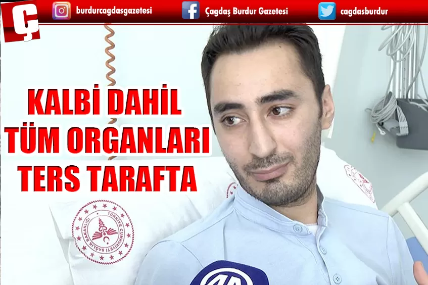 KALBİ DAHİL TÜM ORGANLARI TERS TARAFTA