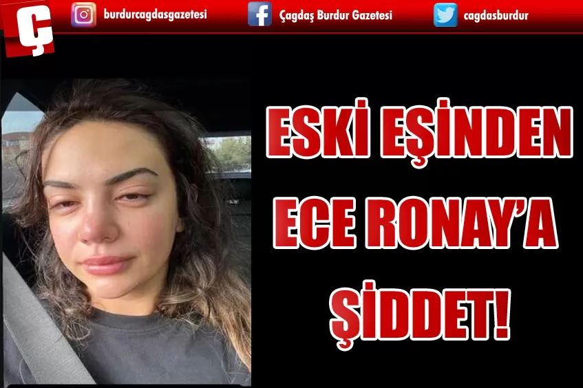 ECE RONAY'A ESKİ EŞİNDEN ŞİDDET!