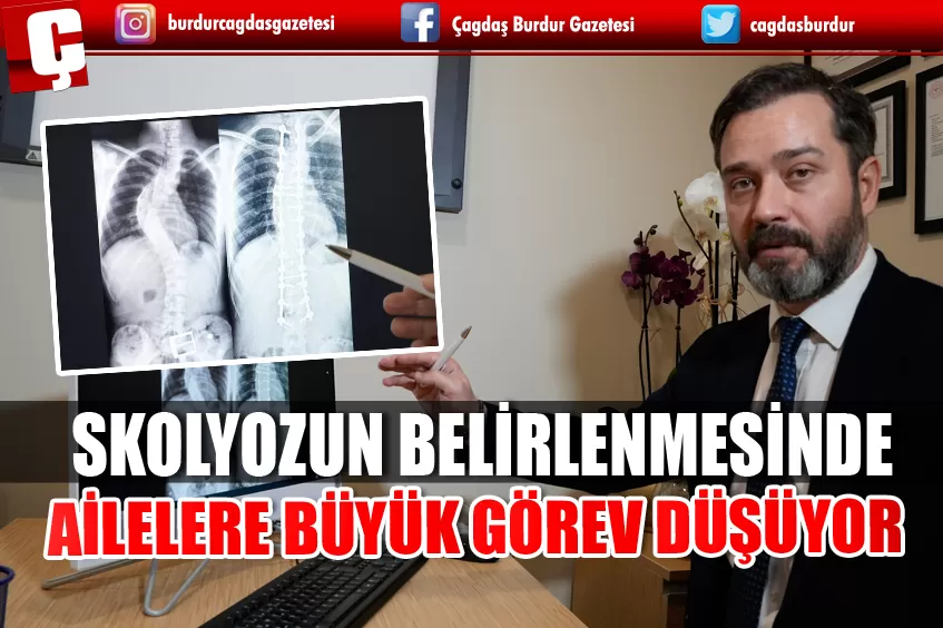 SKOLYOZUN BELİRLENMESİNDE AİLELERE BÜYÜK GÖREV DÜŞÜYOR