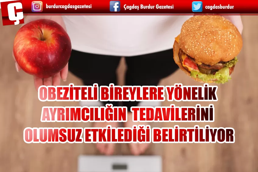 OBEZİTELİ BİREYLERE YÖNELİK AYRIMCILIĞIN TEDAVİLERİNİ OLUMSUZ ETKİLEDİĞİ BELİRTİLİYOR