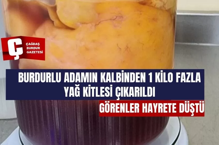 BURDUR'DA SIRA DIŞI BİR AMELİYAT HİKAYESİ