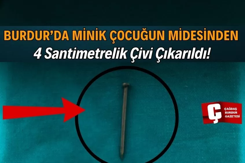 BURDUR’DA 2 YAŞINDAKİ ÇOCUĞUN MİDESİNDE BULUNAN ÇİVİ, ÖLÜMDEN DÖNDÜRDÜ!
