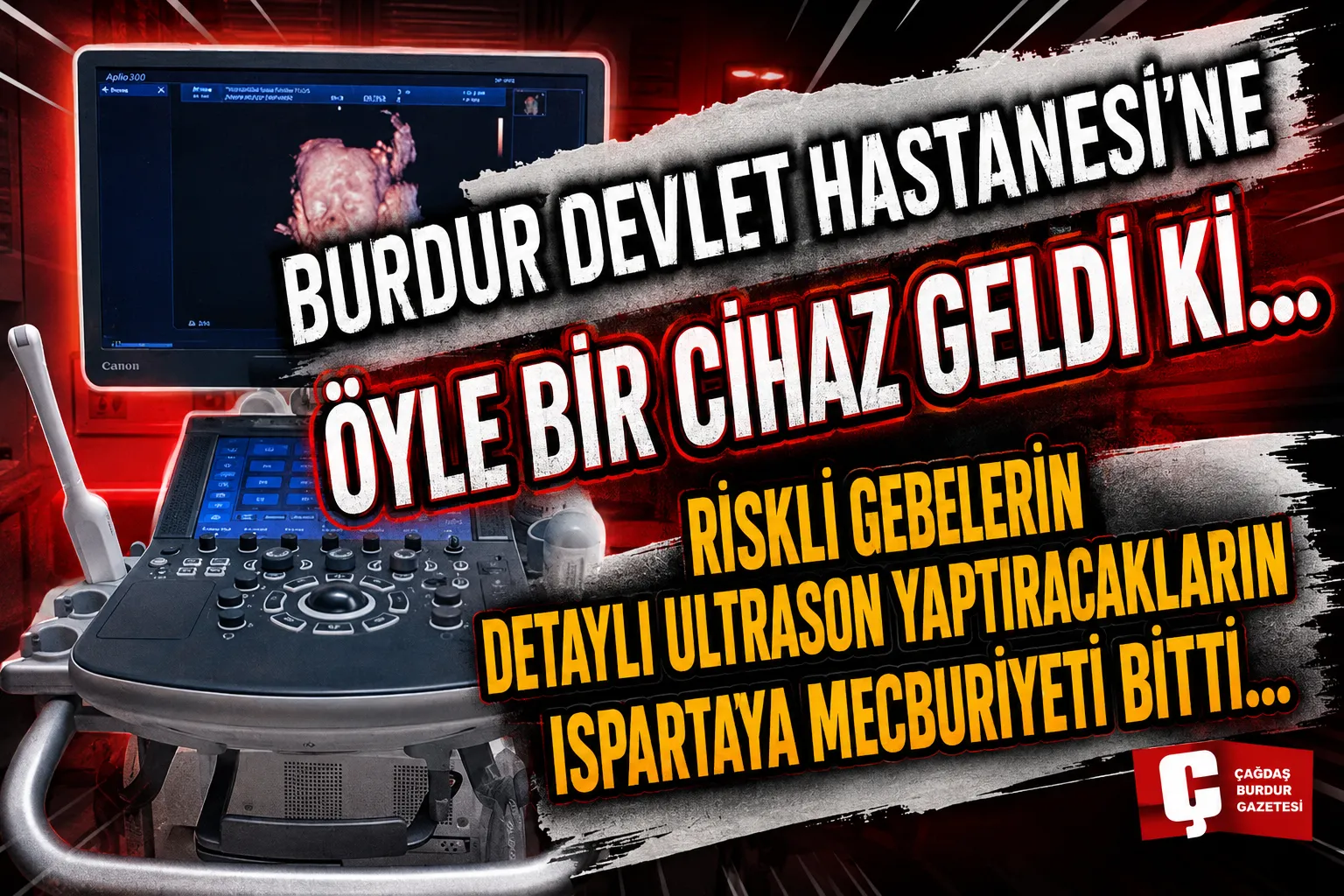 RİSKLİ GEBELERİN DETAYLI GÖRÜNTÜLEMELER İÇİN BURDUR’DAN KOMŞU İLLERE SEVKİ SONA ERİYOR